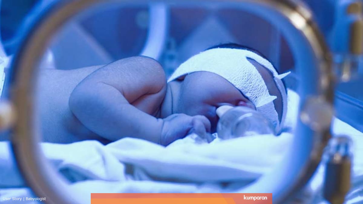 Cara Memakai Lampu Untuk Bayi Kuning - LAMPUTASOR